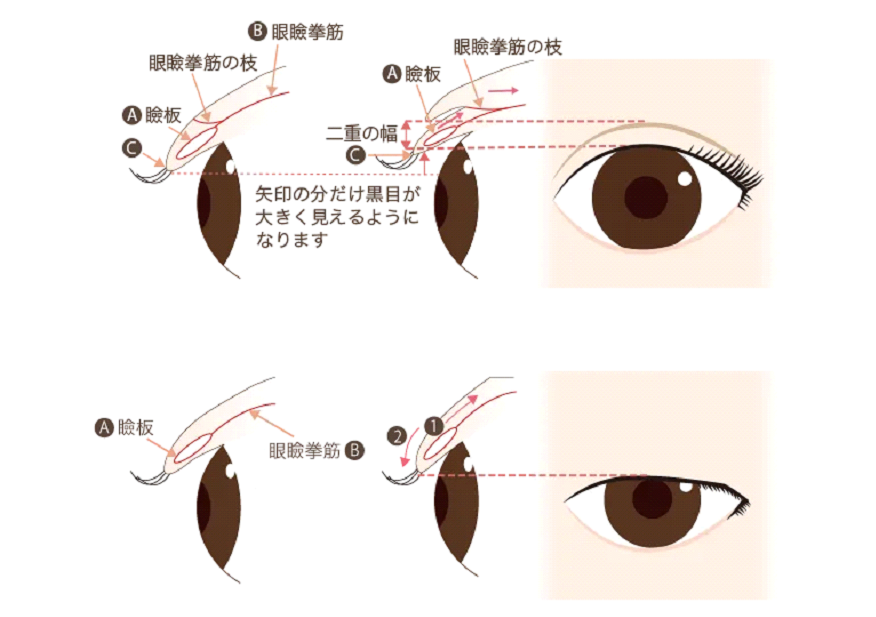 二重画像