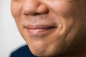 鼻毛の医療脱毛は可能？