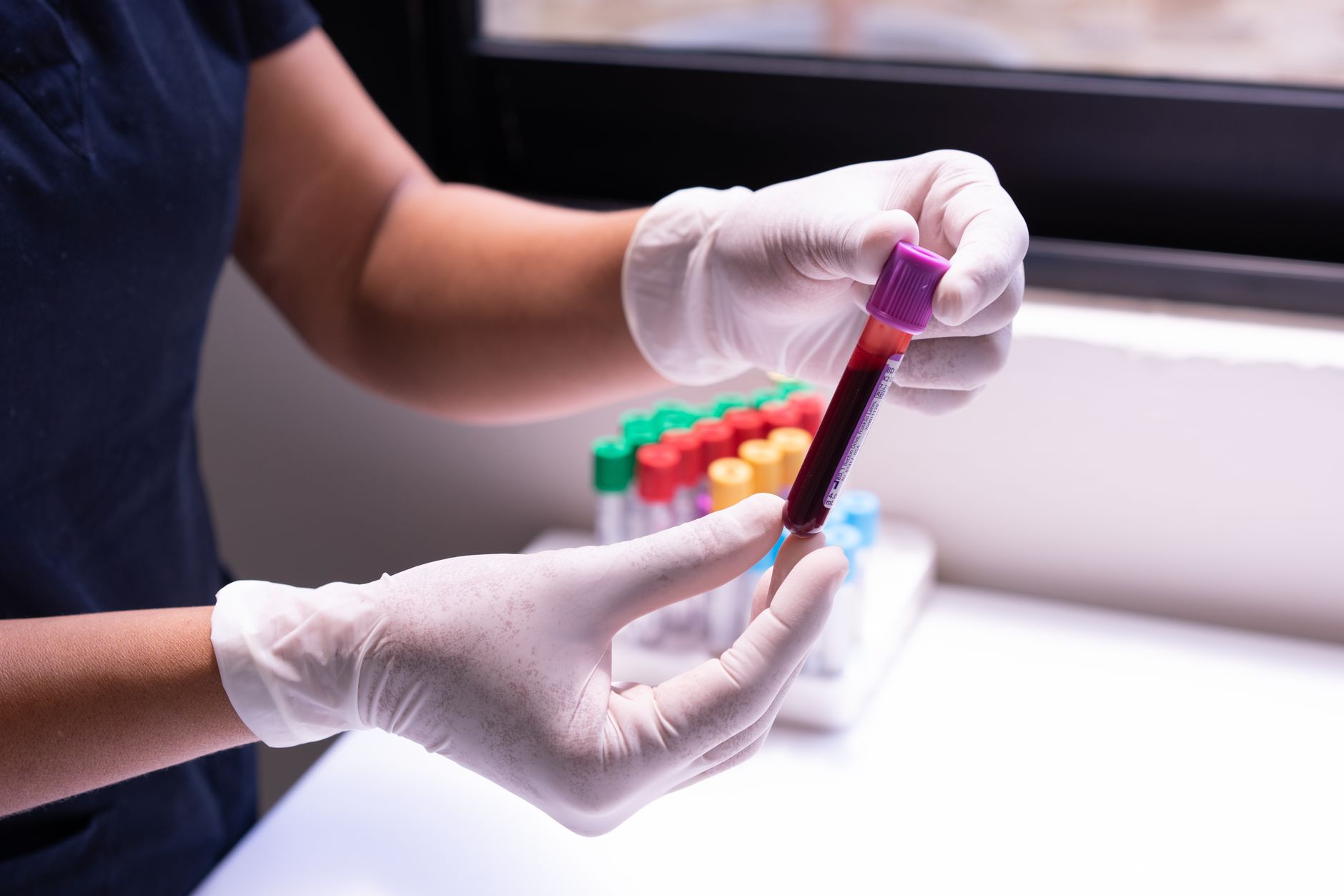 Male Gonorrhea: Symptoms, Incubation Period, Treatment & Risks of Untreated Infection