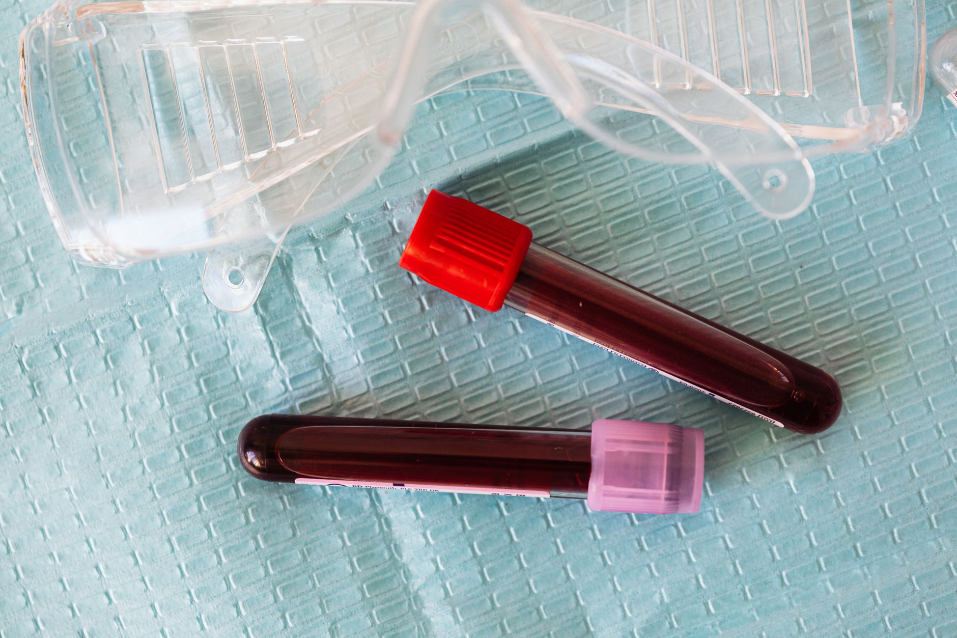 Hepatitis C (HCV) in Men – DAA Therapy Achieves SVR Over 95%