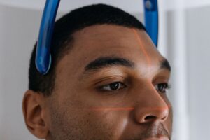 Medical Laser Hair Removal for Men in Shimbashi, Tokyo